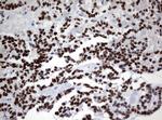 ZSCAN18 Antibody in Immunohistochemistry (Paraffin) (IHC (P))