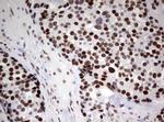 ZSCAN18 Antibody in Immunohistochemistry (Paraffin) (IHC (P))