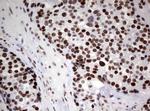 ZSCAN18 Antibody in Immunohistochemistry (Paraffin) (IHC (P))