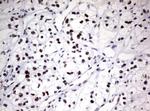 ZSCAN18 Antibody in Immunohistochemistry (Paraffin) (IHC (P))