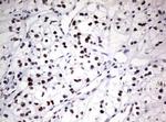 ZSCAN18 Antibody in Immunohistochemistry (Paraffin) (IHC (P))
