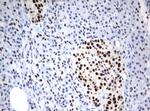 ZSCAN18 Antibody in Immunohistochemistry (Paraffin) (IHC (P))