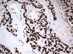 ZSCAN18 Antibody in Immunohistochemistry (Paraffin) (IHC (P))