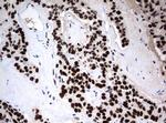 ZSCAN18 Antibody in Immunohistochemistry (Paraffin) (IHC (P))