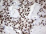 ZSCAN18 Antibody in Immunohistochemistry (Paraffin) (IHC (P))