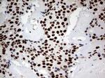 ZSCAN18 Antibody in Immunohistochemistry (Paraffin) (IHC (P))