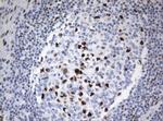 ZSCAN18 Antibody in Immunohistochemistry (Paraffin) (IHC (P))