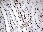 ZSCAN18 Antibody in Immunohistochemistry (Paraffin) (IHC (P))