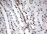 ZSCAN18 Antibody in Immunohistochemistry (Paraffin) (IHC (P))