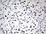 ZSCAN18 Antibody in Immunohistochemistry (Paraffin) (IHC (P))