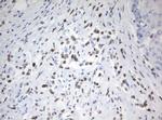 ZSCAN18 Antibody in Immunohistochemistry (Paraffin) (IHC (P))