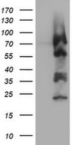 ZSCAN18 Antibody in Western Blot (WB)
