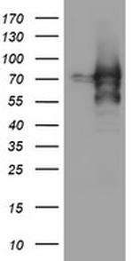 ZSCAN18 Antibody in Western Blot (WB)