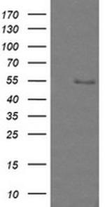ZSCAN18 Antibody in Western Blot (WB)