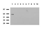 ZSCAN18 Antibody in Western Blot (WB)