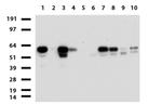 ZSCAN18 Antibody in Western Blot (WB)