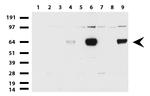 ZSCAN18 Antibody in Western Blot (WB)