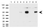 ZSCAN18 Antibody in Western Blot (WB)