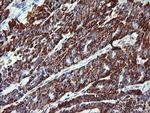 ZSCAN21 Antibody in Immunohistochemistry (Paraffin) (IHC (P))