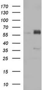 ZSCAN21 Antibody in Western Blot (WB)