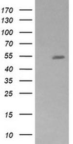ZSCAN21 Antibody in Western Blot (WB)
