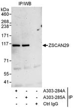 ZSCAN29 Antibody in Immunoprecipitation (IP)