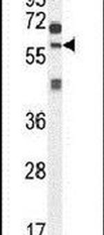 ZSWIM1 Antibody in Western Blot (WB)