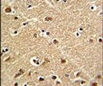 ZWINT Antibody in Immunohistochemistry (IHC)