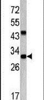 ZWINT Antibody in Western Blot (WB)