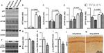 Tau Antibody in Western Blot (WB)