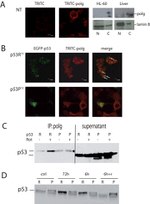 POLG Antibody in Western Blot, Immunoprecipitation (WB, IP)