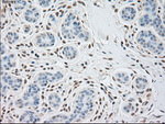 alpha-actinin (Actinin alpha 1) Antibody in Immunohistochemistry (Paraffin) (IHC (P))