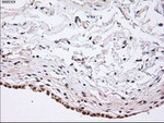alpha-actinin (Actinin alpha 1) Antibody in Immunohistochemistry (Paraffin) (IHC (P))