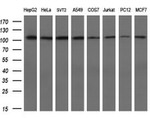 alpha-actinin (Actinin alpha 1) Antibody in Western Blot (WB)