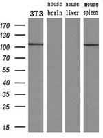 alpha-actinin (Actinin alpha 1) Antibody in Western Blot (WB)