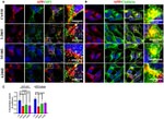 Clathrin Heavy Chain Antibody in Immunocytochemistry (ICC/IF)