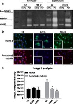 Acetyl-alpha Tubulin (Lys40) Antibody in Immunocytochemistry (ICC/IF)