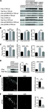 Phospho-Tau (Ser396) Antibody in Western Blot (WB)