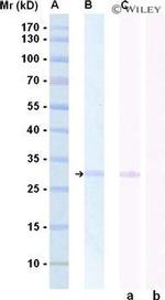PSA Antibody in Western Blot (WB)