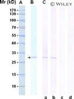 PSA Antibody in Western Blot (WB)