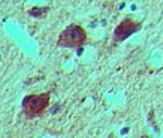 14-3-3 zeta Antibody in Immunohistochemistry (Paraffin) (IHC (P))