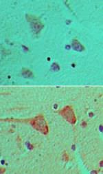 14-3-3 zeta Antibody in Immunohistochemistry (Paraffin) (IHC (P))