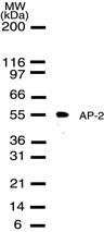 AP2 alpha Antibody in Western Blot (WB)