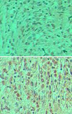 ARAP2 Antibody in Immunohistochemistry (Paraffin) (IHC (P))