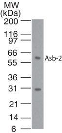 ASB2 Antibody in Western Blot (WB)