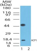Acid Phosphatase 1 Antibody in Western Blot (WB)