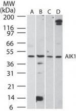 Aurora B Antibody in Western Blot (WB)