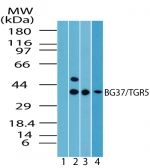 TGR5 Antibody in Western Blot (WB)