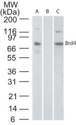 BRD4 Antibody in Western Blot (WB)