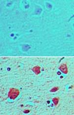 BST-1 Antibody in Immunohistochemistry (Paraffin) (IHC (P))